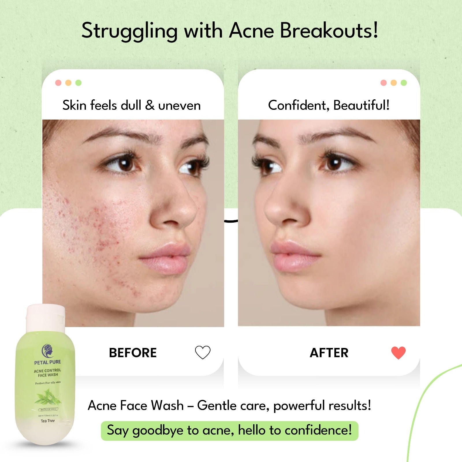 Petal Pure Acne Control Face Wash